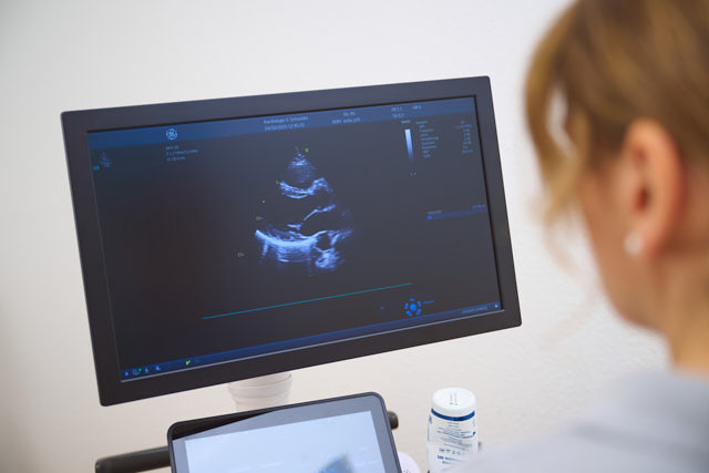 Echokardiographie Kardiologie Schneider